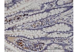 Immunoperoxidase of monoclonal antibody to MGAT5 on formalin-fixed paraffin-embedded human small Intestine.