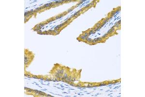Immunohistochemistry of paraffin-embedded human prostate using BTD antibody (ABIN6127510, ABIN6137680, ABIN6137682 and ABIN6221882) at dilution of 1:100 (40x lens). (BTD Antikörper  (AA 284-543))