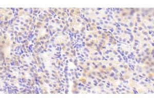 Immunohistochemistry (IHC) image for anti-Golgi Membrane Protein 1 (GOLM1) (AA 119-223) antibody (ABIN7433906)