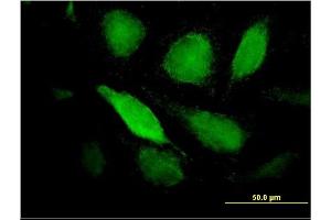 Immunofluorescence of monoclonal antibody to PTX3 on HeLa cell. (PTX3 Antikörper  (AA 282-380))