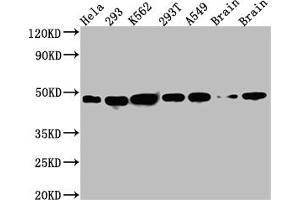 Western Blot Positive WB detected in: Hela whole cell lysate, 293 whole cell lysate, K562 whole cell lysate, 293T whole cell lysate, A549 whole cell lysate, Rat Brain whole cell lysate, Mouse Brain whole cell lysate All lanes: NUDC antibody at 1:1000 Secondary Goat polyclonal to rabbit IgG at 1/50000 dilution Predicted band size: 39 kDa Observed band size: 45 kDa (Rekombinanter NUDC Antikörper)