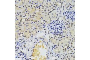 Immunohistochemistry of paraffin-embedded mouse kidney using HNRNPA1 Antibody (ABIN5975570) at dilution of 1/100 (40x lens). (HNRNPA1 Antikörper)