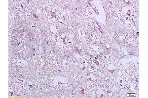 Immunohistochemistry (IHC) image for anti-BCL2-Associated X Protein (BAX) (AA 84-175) antibody (ABIN725390)