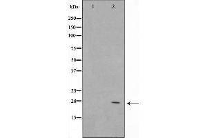 Western blot analysis on Jurkat cell lysate using C1orf57 Antibody (C1orf57 Antikörper  (C-Term))