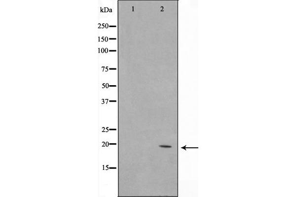 C1orf57 antibody  (C-Term)