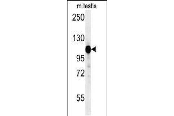 DACT1 Antikörper  (N-Term)