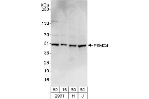 Western Blotting (WB) image for anti-Proteasome (Prosome, Macropain) 26S Subunit, ATPase, 4 (PSMC4) (AA 1-50) antibody (ABIN7454973)