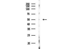 Western blot analysis of lysates from HUVEC cells(heat-shock, 45 min treatment), using KCNJ14 Antibody at 1/1000 dilution.