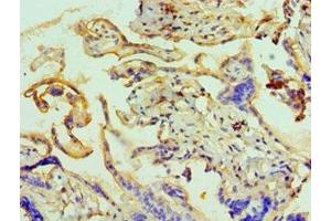 Immunohistochemistry of paraffin-embedded human placenta tissue using ABIN7144073 at dilution of 1:100 (ANAPC5 Antikörper  (AA 1-250))