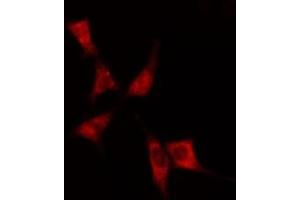 ABIN6275060 staining  Hela cells by IF/ICC. (DHODH Antikörper  (Internal Region))