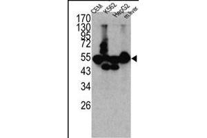 Western blot analysis of CPN1 antibody (N-term) (ABIN391509 and ABIN2841471) in K562, CEM, HEpG2 cell line lysates and mouse liver tissue lysates (35 μg/lane). (CPN1 Antikörper  (N-Term))