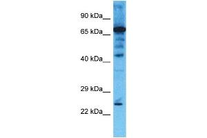 Host: Rabbit  Target Name: CHMP4B  Sample Tissue: Jurkat Whole Cell lysates  Antibody Dilution: 1. (CHMP4B Antikörper  (Middle Region))