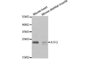 Western blot analysis of extracts of various cell lines, using ATF3 antibody. (ATF3 Antikörper  (AA 1-181))