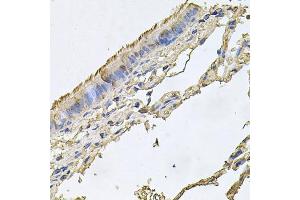 Immunohistochemistry of paraffin-embedded human trachea using FABP12 antibody. (FABP12 Antikörper)