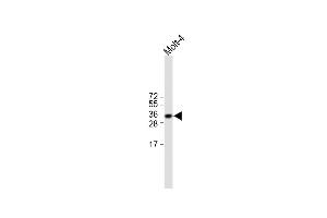 All lanes : Anti-TRBC1 Antibody (Center) at 1:500 dilution Lane 1: Molt-4 whole cell lysate Lysates/proteins at 20 μg per lane. (TRBC1 Antikörper  (AA 104-136))