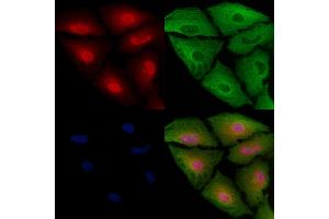 ABIN6263080 and ABIN6272519 staining  cells by IF/ICC. (MAGEH1 Antikörper  (N-Term))