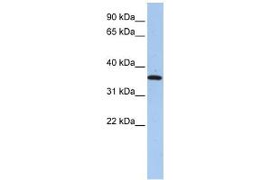 FAM84A antibody used at 1 ug/ml to detect target protein. (FAM84A Antikörper  (N-Term))
