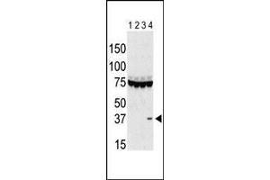 The anti-Aurora C Pab g is used in Western blot to detect Aurora C in lysates of 293 cells expressing Flag tag (lane 1), Flag-tagged Aurora A (lane 2), Flag-tagged Aurora B (lane 3), and Flag-tagged Aurora C (lane 4).