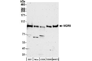 anti-WD Repeat Domain 6 (WDR6) (AA 1071-1121) antibody