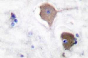Image no. 1 for anti-Cadherin 1, Type 1, E-Cadherin (Epithelial) (CDH1) (Arg3) antibody (ABIN265314)