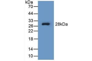 Detection of Recombinant PAH, Human using Polyclonal Antibody to Phenylalanine Hydroxylase (PAH) (Phenylalanine Hydroxylase Antikörper  (AA 1-226))