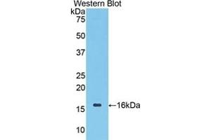 Detection of Recombinant CDK1, Mouse using Polyclonal Antibody to Cyclin Dependent Kinase 1 (CDK1) (CDK1 Antikörper  (AA 59-181))