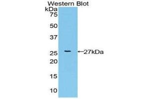 Western Blotting (WB) image for anti-Fibroblast Growth Factor Receptor-Like 1 (FGFRL1) (AA 168-378) antibody (ABIN3202407)