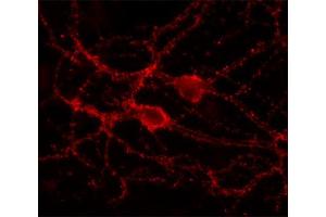 Indirect immunolabeling of cultured rat hippocampus neurons (dilution 1 : 500).