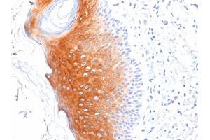 Formalin-fixed, paraffin-embedded human Skin stained with Cytokeratin 1 Mouse Monoclonal Antibody (LHK1).