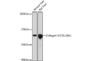 Western blot analysis of extracts of various cell lines, using Collagen X/COL10 Rabbit mAb (1645) at 1:1000 dilution.