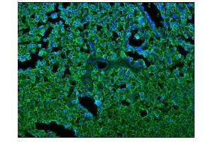 IF analysis of CD45/PTPRC using anti-CD45/PTPRC antibody (ABIN7599666).