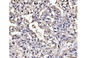 IHC analysis of GHITM using anti-GHITM antibody (ABIN7599294). (GHITM Antikörper  (AA 1-345))