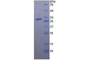 SDS-PAGE analysis of Rat Toll Like Receptor 4 Protein. (TLR4 Protein)