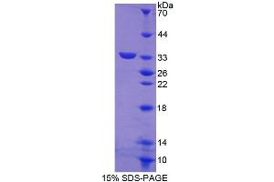 Image no. 1 for ATP-Binding Cassette, Sub-Family G (WHITE), Member 8 (ABCG8) (AA 1-272) protein (His tag) (ABIN4989935)