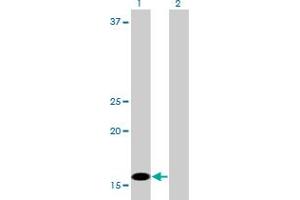 Western Blot analysis of C1D expression in transfected 293T cell line by C1D monoclonal antibody (M03A), clone 6H2. (C1D Antikörper  (AA 1-141))