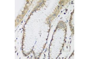 Immunohistochemistry of paraffin-embedded human stomach using METTL7A antibody. (METTL7A Antikörper  (AA 30-244))