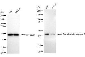 Western blotting analysis using Somatostatin receptor 5 antibody (ABIN7800403). (Rekombinanter SSTR5 Antikörper)