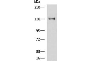 Western blot analysis of Hela cell lysate using PRPF40A Polyclonal Antibody at dilution of 1:800 (PRPF40A Antikörper)