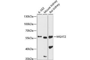 Western blot analysis of extracts of various cell lines, using MG antibody (ABIN6131880, ABIN6143811, ABIN6143812 and ABIN6224904) at 1:1000 dilution. (MGAT2 Antikörper  (AA 178-447))