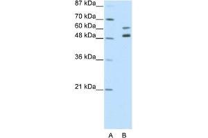 WB Suggested Anti-ZNF682 Antibody Titration:  2. (ZNF682 Antikörper  (N-Term))