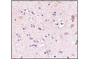 Immunohistochemistry of SATB2 in human brain with this product at 5 μg/ml. (SATB2 Antikörper  (C-Term))
