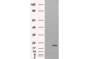 HEK293T cells were transfected with the pCMV6-ENTRY control (Left lane) or pCMV6-ENTRY NIT2 (Right lane) cDNA for 48 hrs and lysed. (NIT2 Antikörper)