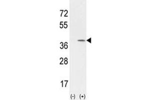 Western blot analysis of CCND1 antibody ans 293 cell lysate (2 ug/lane) either nontransfected (Lane 1) or transiently transfected with the CCND1 gene (2).