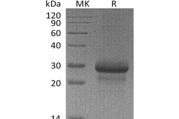 MBL2 蛋白
