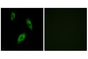 Immunofluorescence analysis of LOVO cells, using GPR174 antibody. (GPR174 Antikörper  (Internal Region))