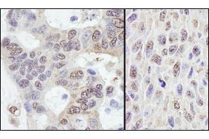 Immunohistochemistry (IHC) image for anti-Protein-Kinase, Interferon-Inducible Double Stranded RNA Dependent Inhibitor, Repressor of (p58 Repressor) (PRKRIR) (AA 150-200) antibody (ABIN7453600)