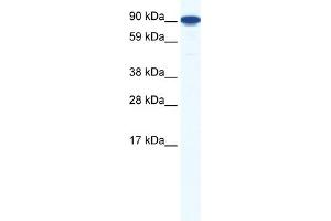 WB Suggested Anti-ZFY1 Antibody Titration:  1.