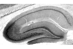 Adult rat hippocampal immunohistochemistry.