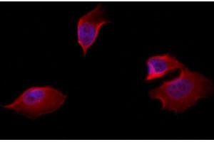 ABIN6257824 and ABIN6274609 staining Hela by IF/ICC.
