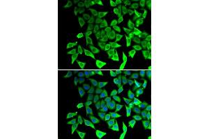 Immunofluorescence analysis of  cells using PTGES2 antibody (ABIN6129084, ABIN6146403, ABIN6146405 and ABIN6217438). (PTGES2 Antikörper  (AA 88-377))